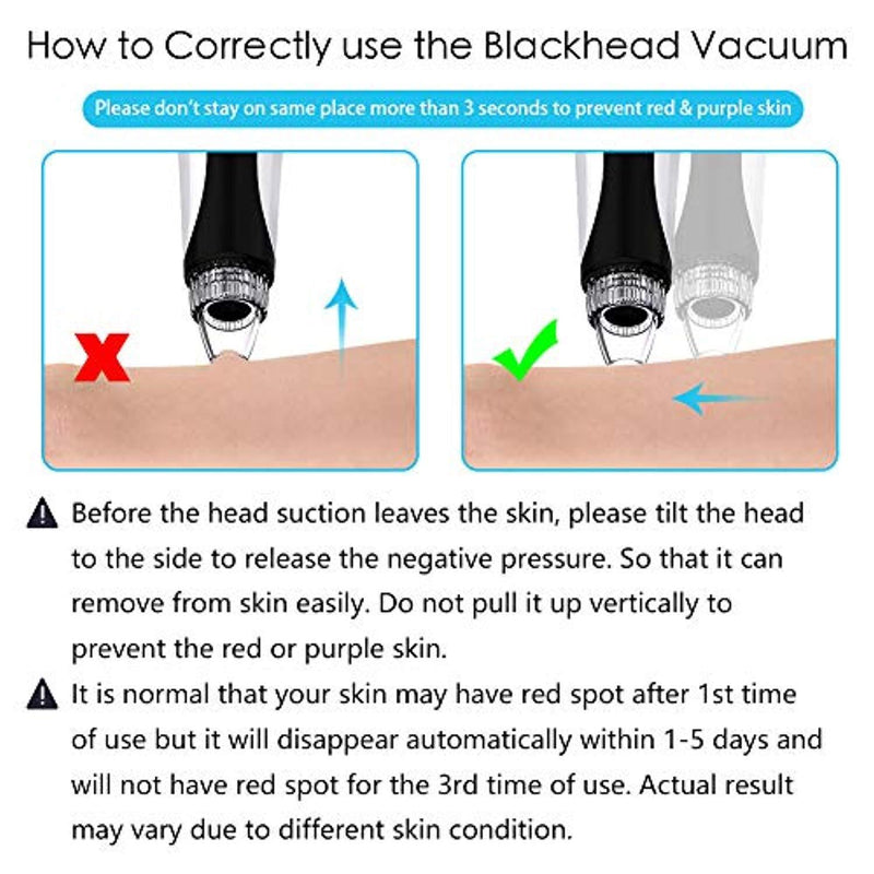 Blackhead Remover, Lanccona Blackhead Vacuum Electric Pore Vacuum with Upgrade Cold / Hot Compress, 3 Model IPL Beauty Lamp Technology, Pore Cleaner Acne Comedo...