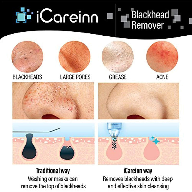 iCareinn Blackhead Remover [Newest 2018] - Rechargeable Pore Vacuum Suction Microdermabrasion Machine Comedone Extractor Acne Remover Electric Skin Cleanser Peeling Tool - Powerful Waterproof Cleaner